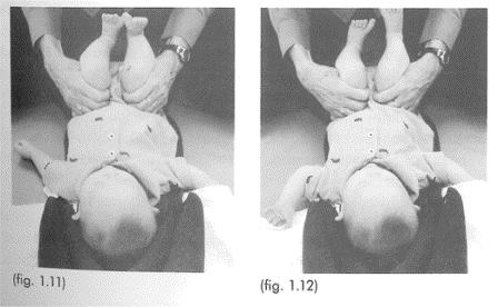 Hip Exercise for Baby with Down Syndrome